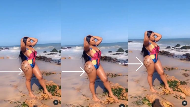 “She Is Covering Her Rotten Hips” – Massive Reaction As Moesha Boduong Flaunts Disturbing Rotten Hips In A Bikini (Video)