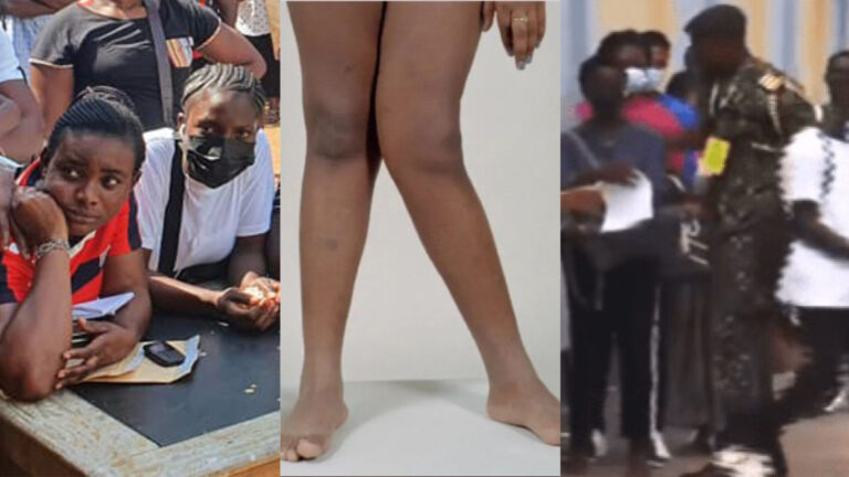 “I Was Told I Have K Legs” – Lady Sadly Recounts How She Was Disqualified At Immigration Service Screening