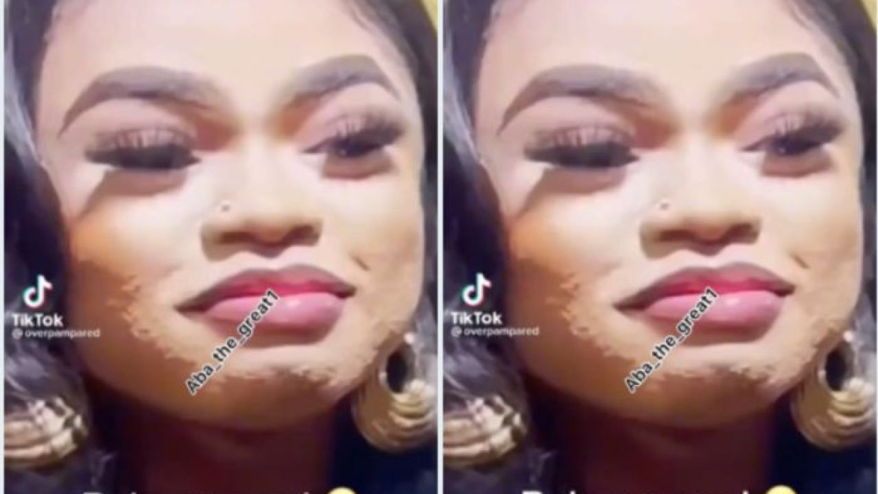 Fans Are Scared As No Makeup Bobrisky Video With Full Beard And Acne Riddled Face Pops Up