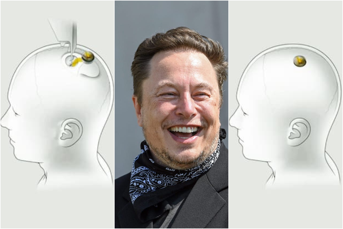 Elon Musk Reveals Microchips For Human Brains