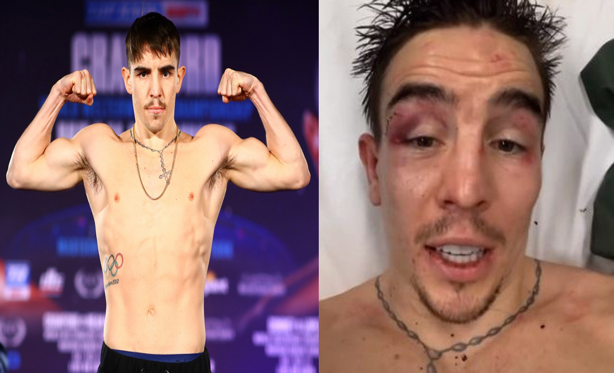 Michael Conlan Condition: How Is Michael Conlan Doing At The Hospital?