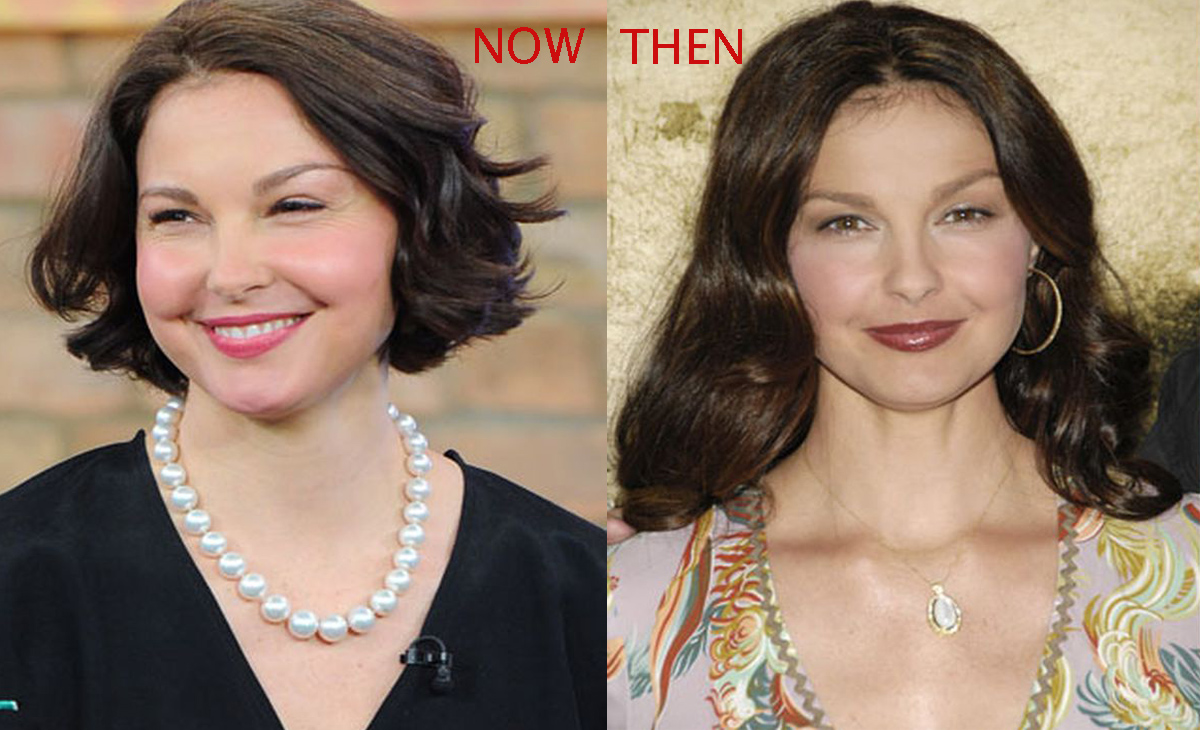 Ashley Judd Now And Then: Ashley Judd Recent Photos After Surgery