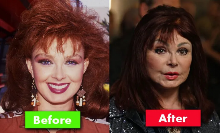 Naomi Judd Plastic Surgery Before And After Photos