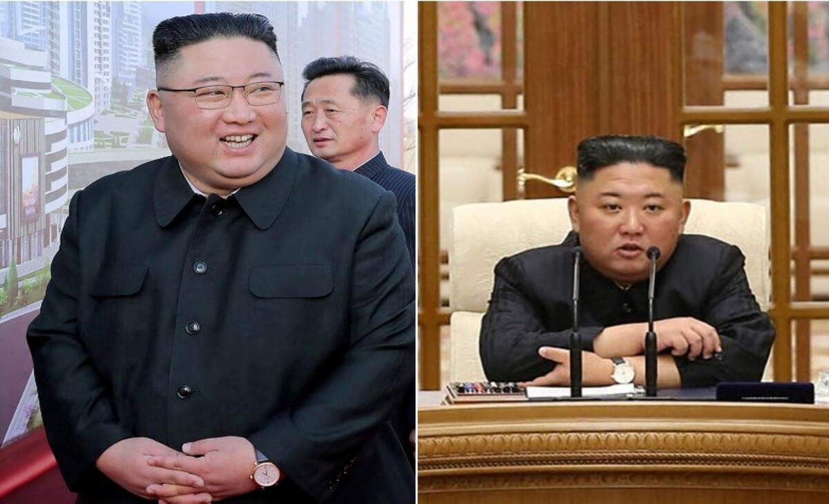 Kim Jong-un Weight Loss
