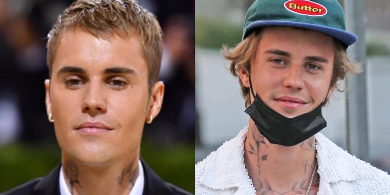 Justin Bieber Reveals He Has Ramsay Hunt Syndrome And His Face Is Partially Paralyzed