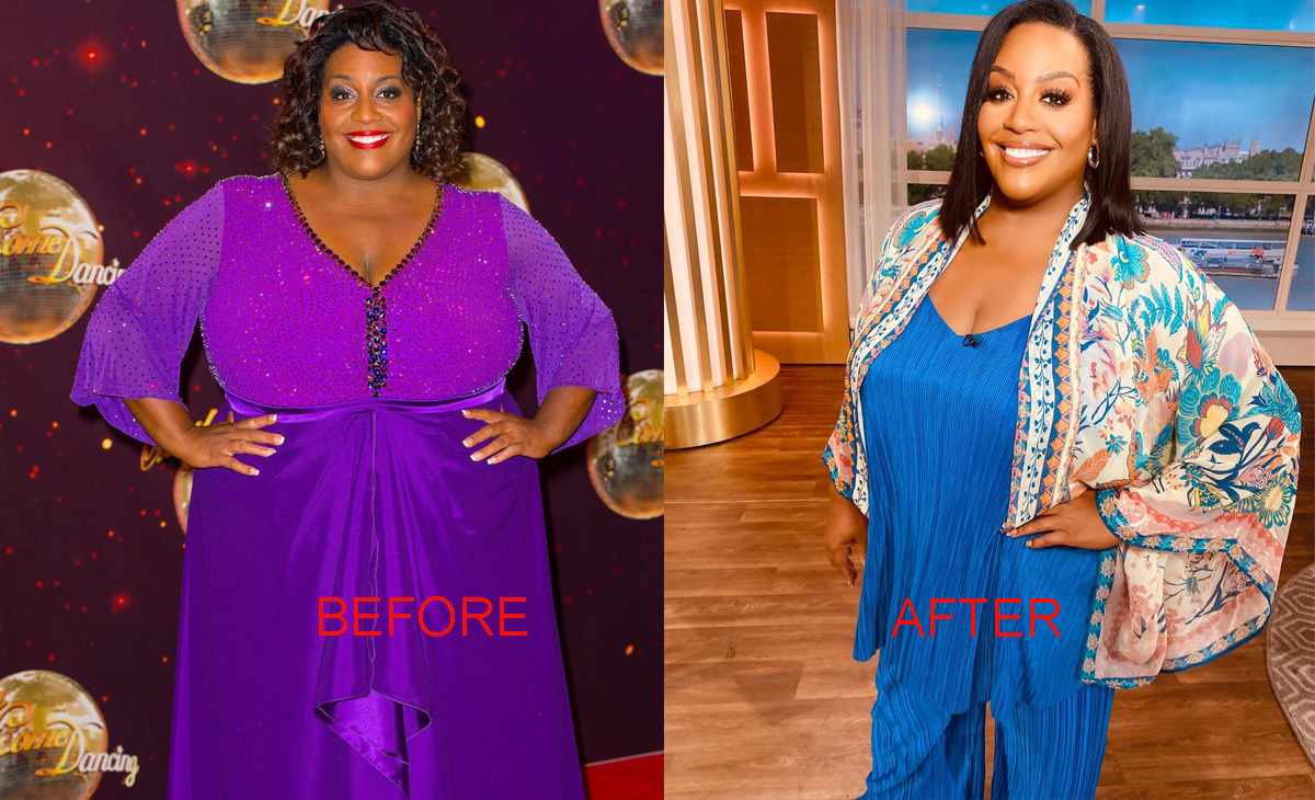 Alison Hammond before and after
