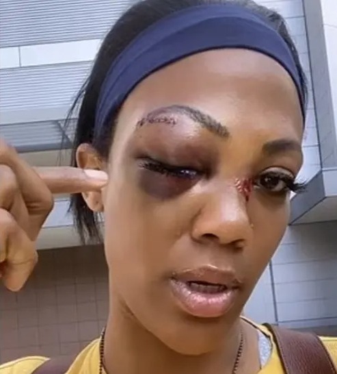 olympian-kim-glass-attacked-by-homeless-man
