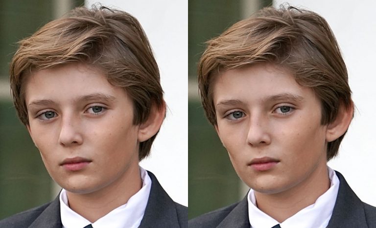 What Height Disease Does Barron Trump Have?